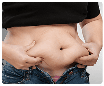 mics-belly-fat